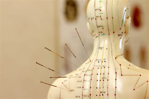  Can Acupuncture Really Heal? Unlocking Ancient Wisdom for Modern Ailments